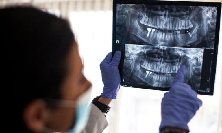 Dentist examining dental X-rays that show implants. The dentist is wearing gloves and a mask, pointing at specific areas on the X-rays. The setting is a well-lit clinic.