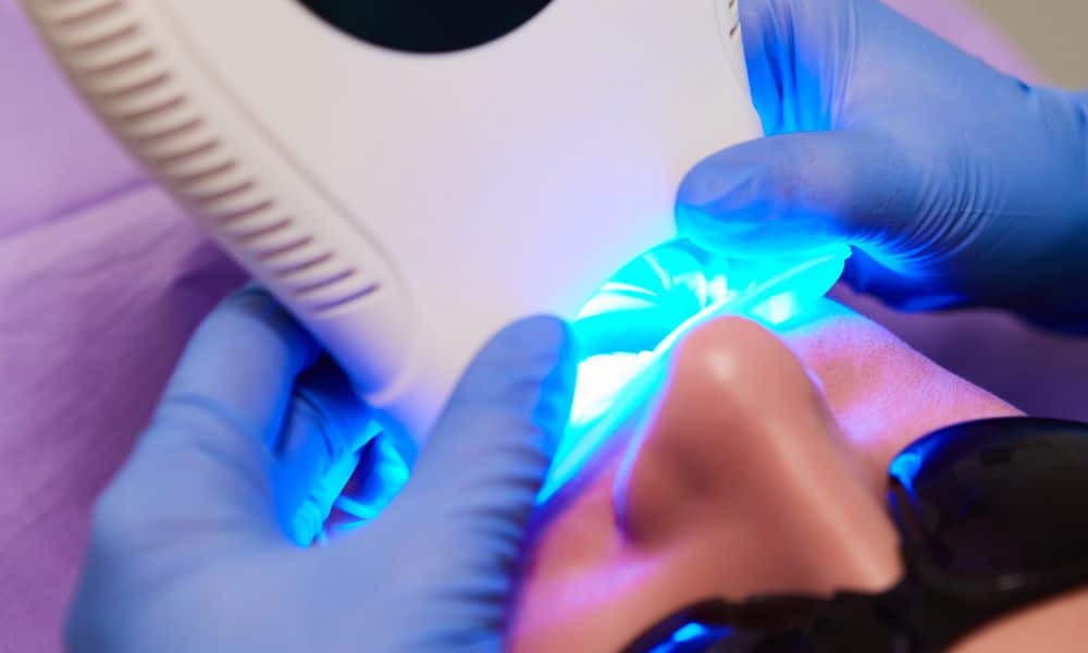 Dentist performing a teeth whitening treatment on a patient using a blue LED light. The patient is wearing protective eyewear, and the dentist is wearing gloves. The procedure is being carried out in a dental clinic.