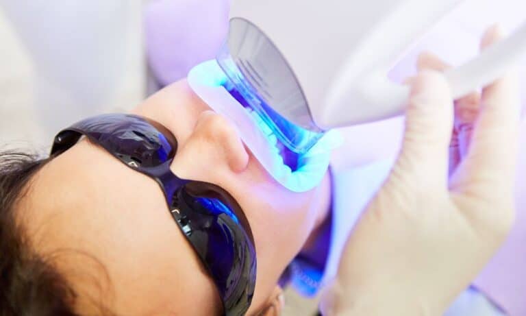 A patient wearing protective goggles undergoing a professional teeth whitening procedure with a blue light device, highlighting the cost of teeth whitening treatments.