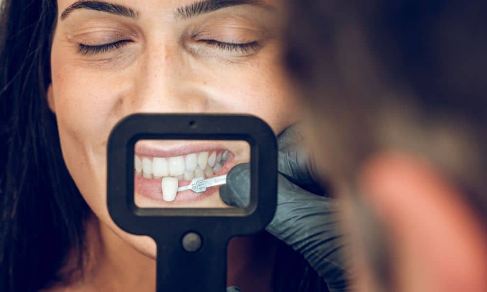 Dentist holding a dental model and shade guide, explaining the durability of veneers. The dentist is wearing blue gloves and a white coat. The background is a clinical setting.