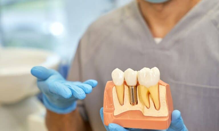 Dentist holding a model of dental implants, showing the structure and components, including artificial teeth and the implant base. The dentist is wearing gloves and a mask, and the background is a dental clinic setting.